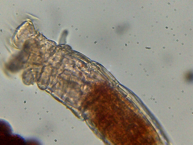 Haematococcus pluvialis e philodina